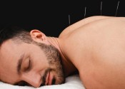 Acupuncture treats pain better than opioids 