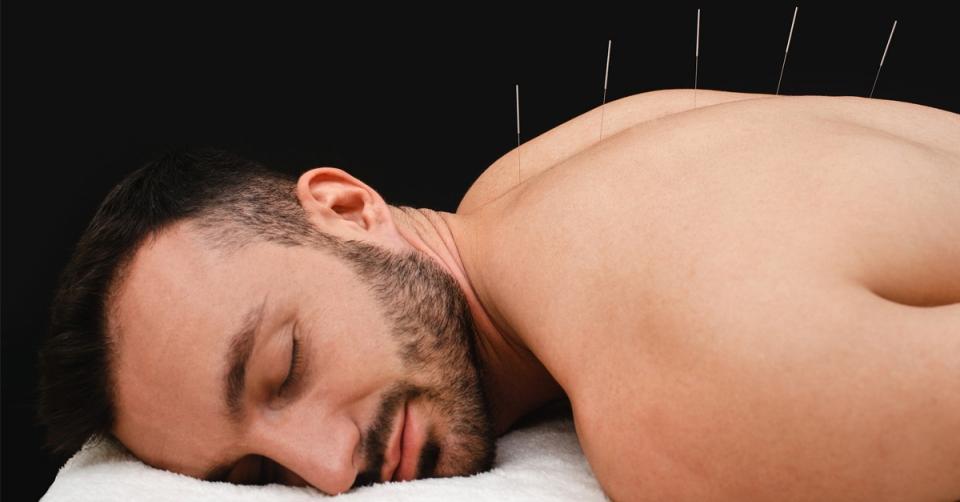 Acupuncture treats pain better than opioids image 